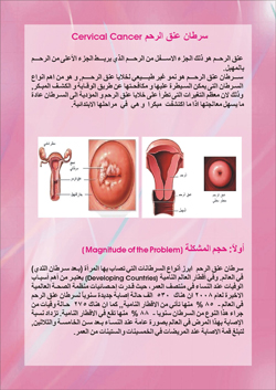 كتيب دليل التوعية والتثـقيف الصحي حول الوقاية والكشف المبكر عن سرطان عنـق الرحـم المركز الوطني الريادي لبحوث السرطان